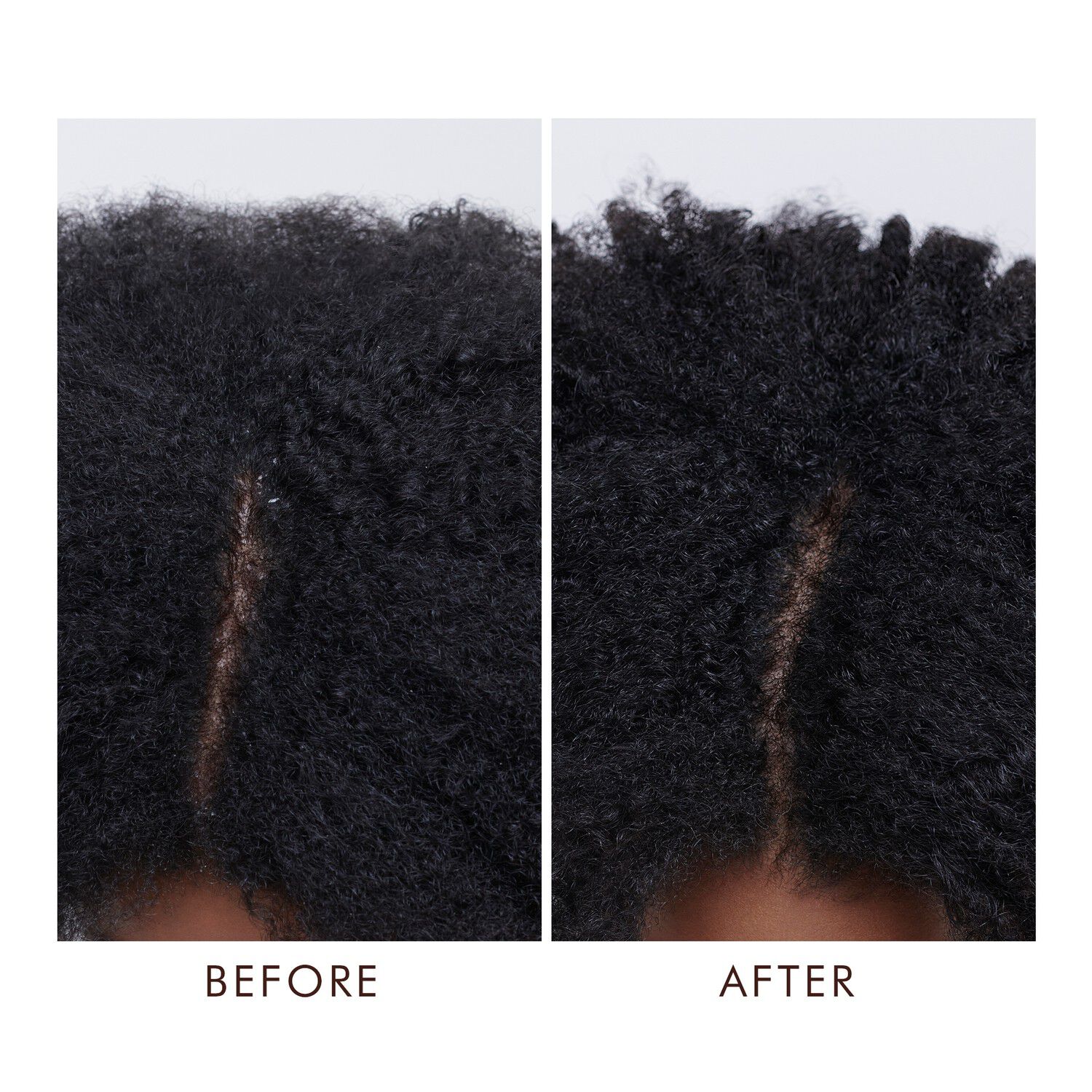 Dry Scalp Treatment, 45 ml.