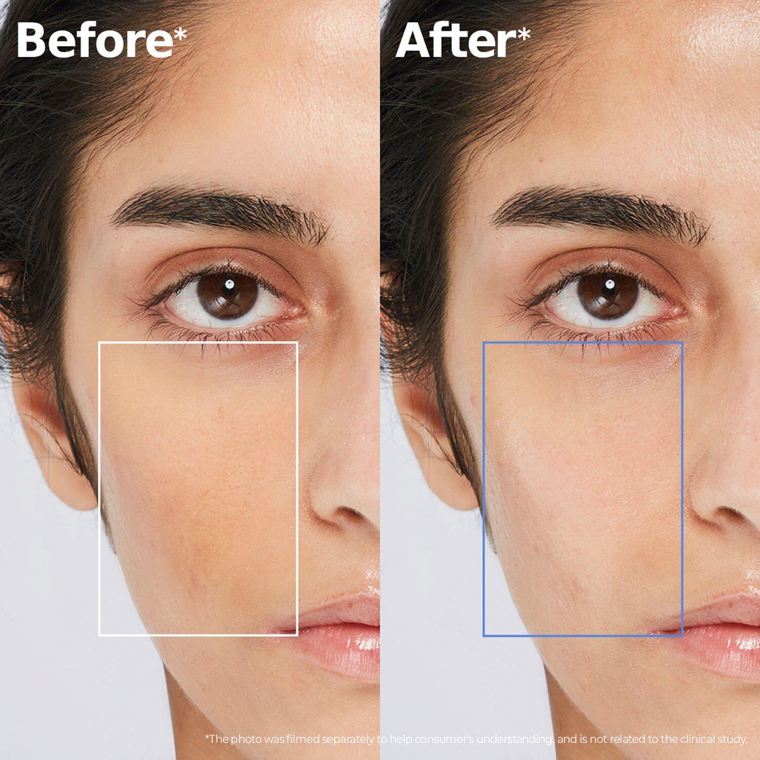 ATOBARRIER365 Hydro-Essence - Fugtgivende essens til hydrering af hudb