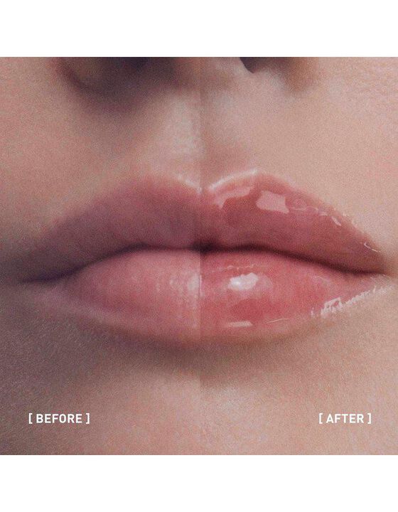 Filorga Hyalu-Filler Lips 4g