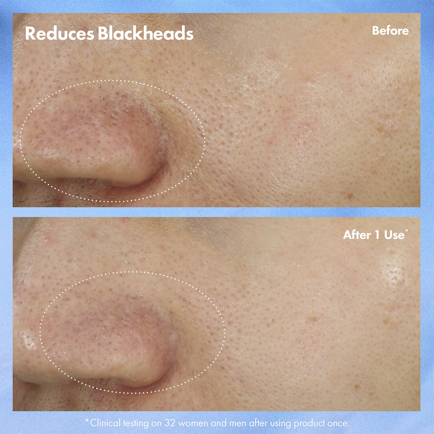 Clear Improvement Blackhead Clearing Mask-To-Scrub