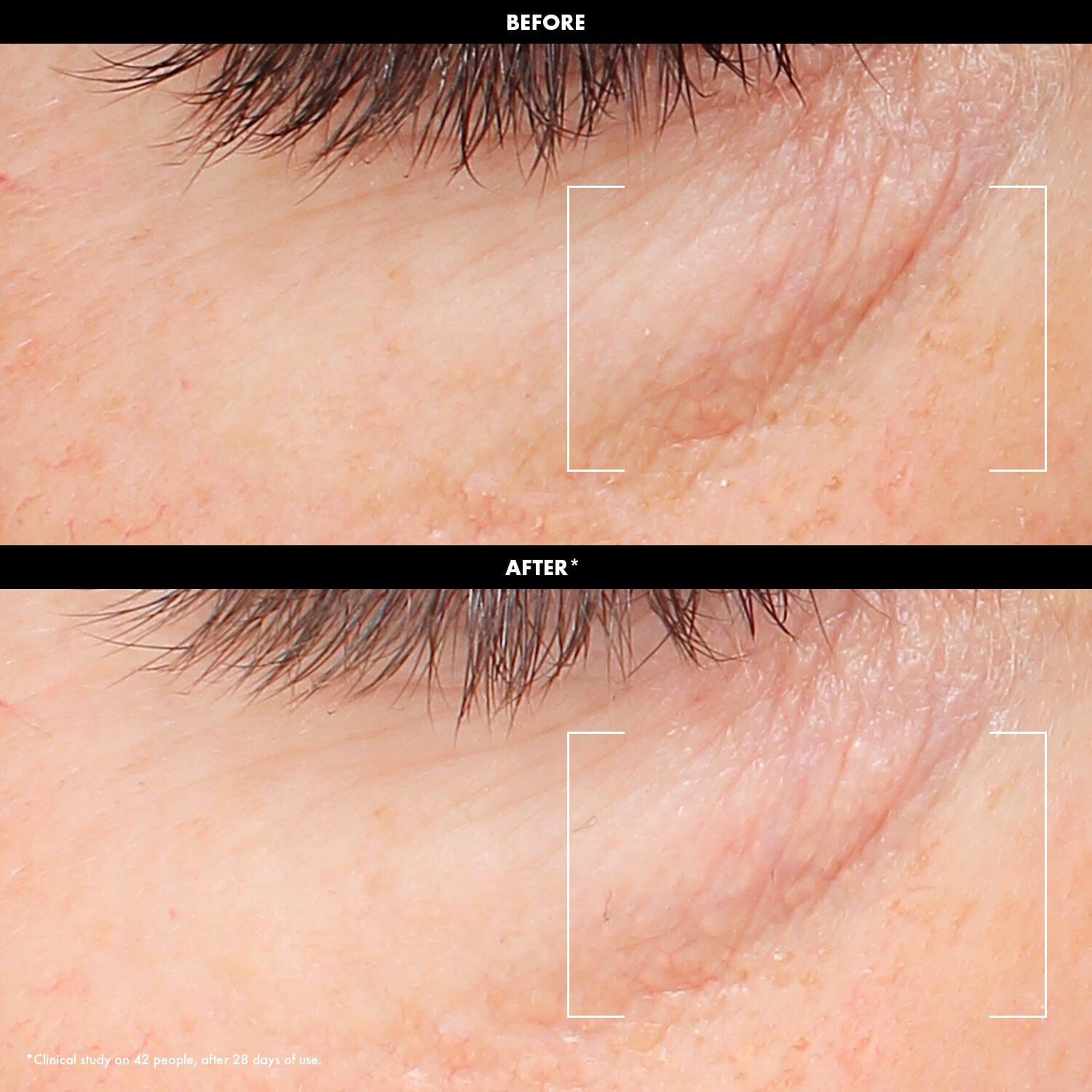 LET'S GET GLOWY SET - Mini-plejes&aelig;t til en hud med gl&oslash;d