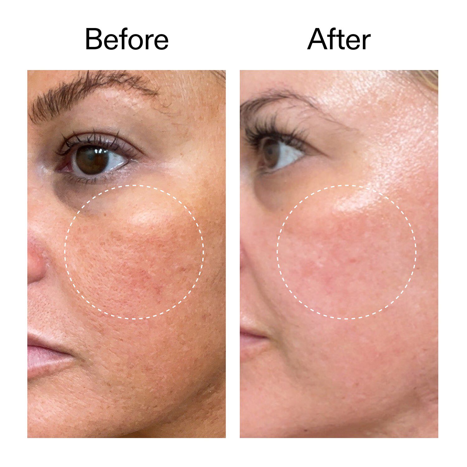 Starter Retinol Serum - Begynderretinolserum