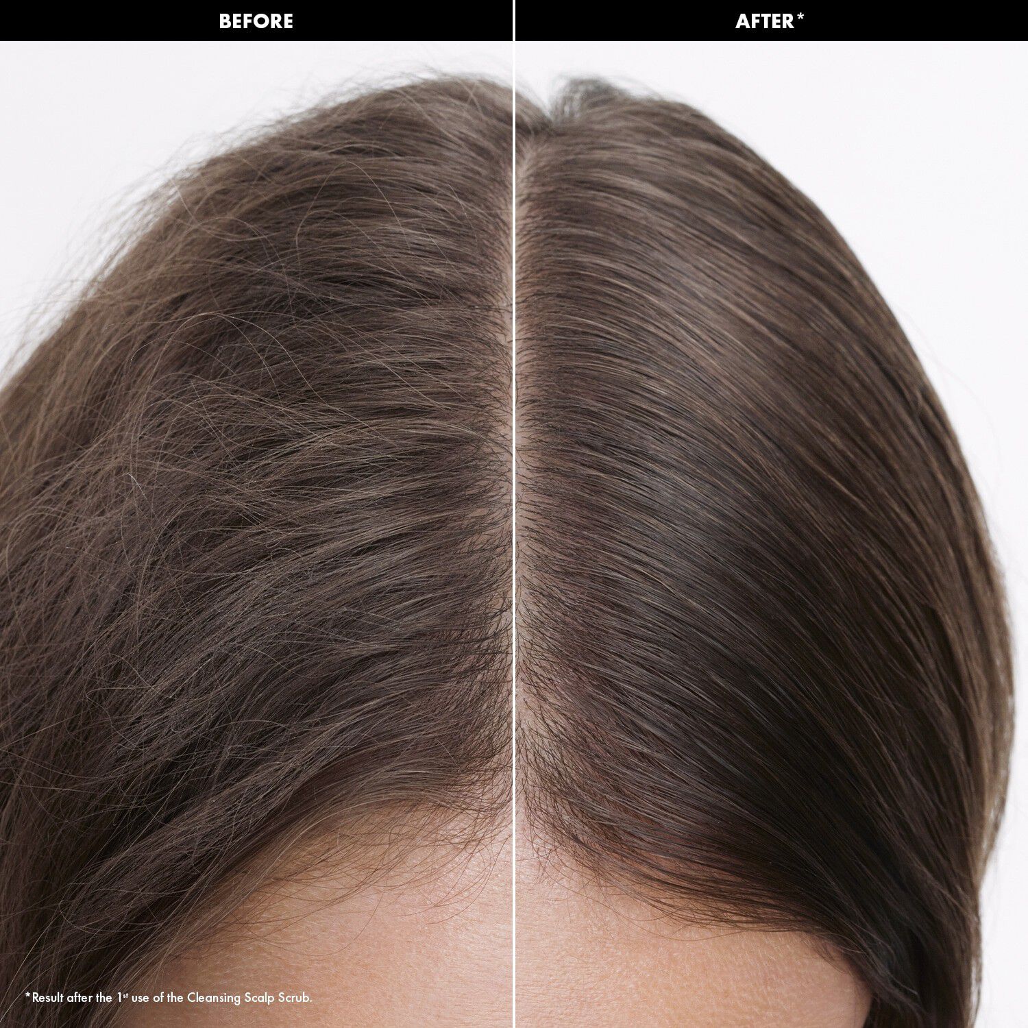 DETOX - Eksfolierende shampoo