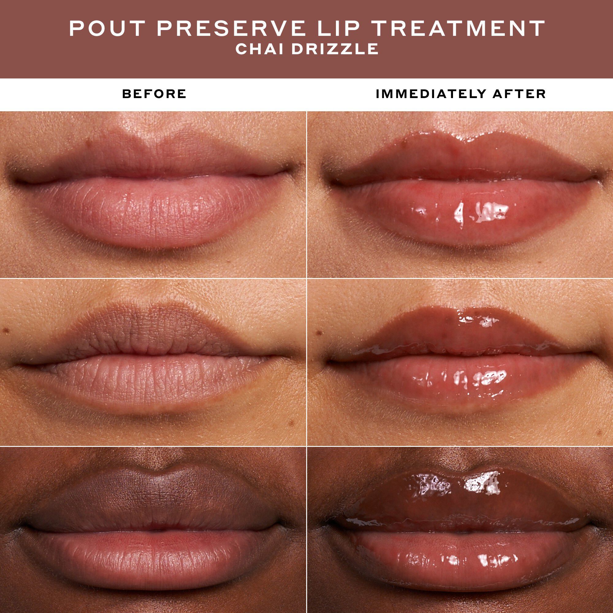 LIP TREATMENT