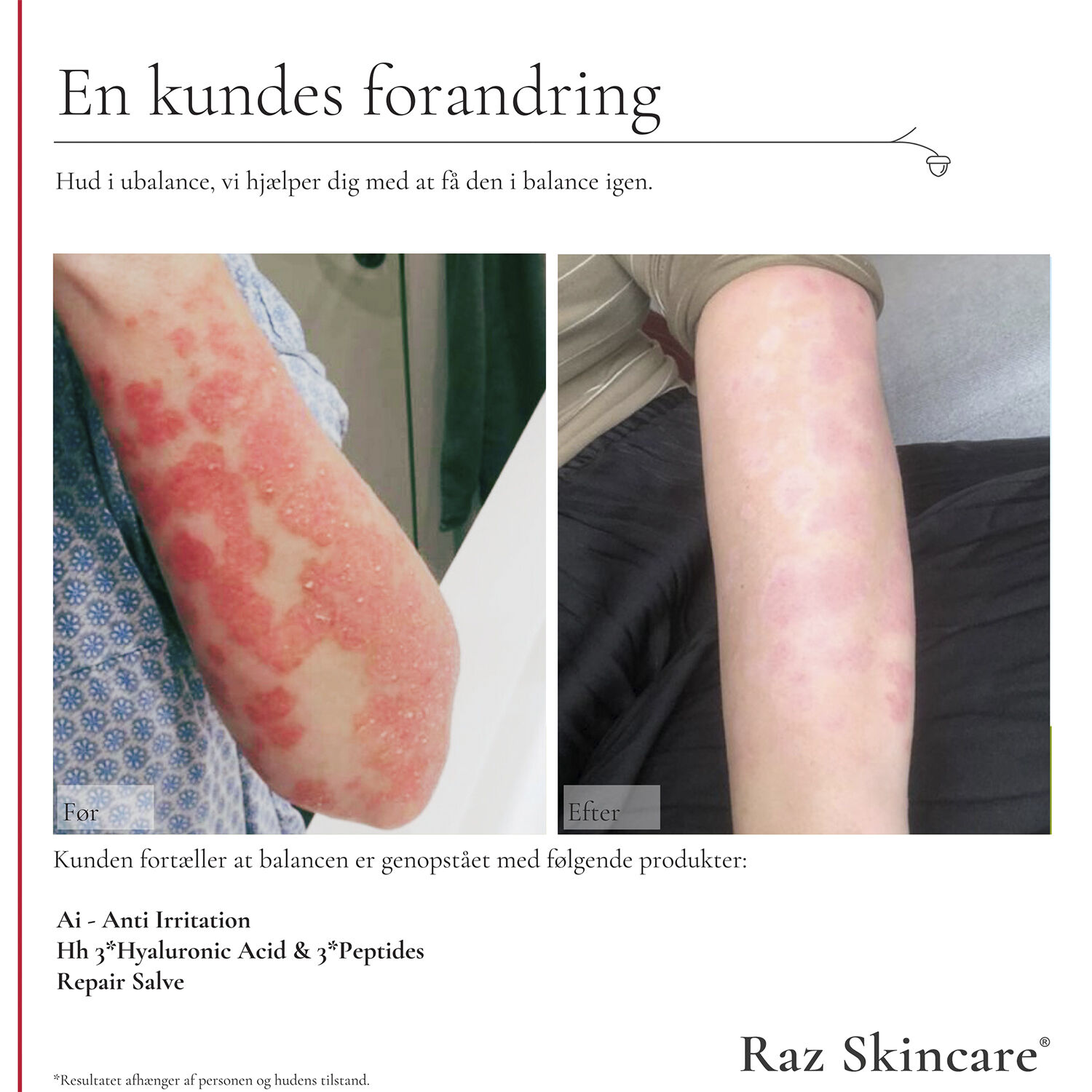 Raz Skincare Repair Salve 100 ml