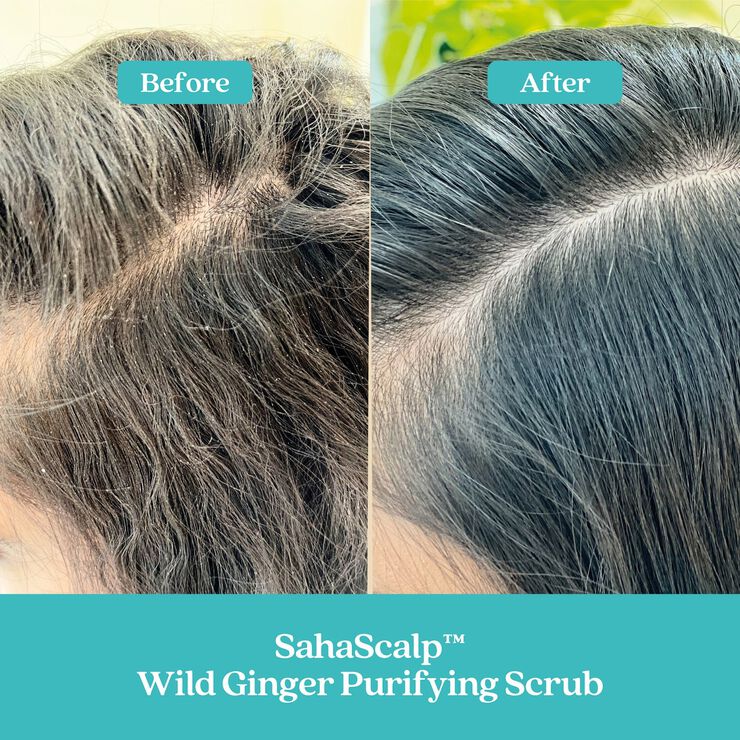 SAHASCALP SCALP RESET KIT