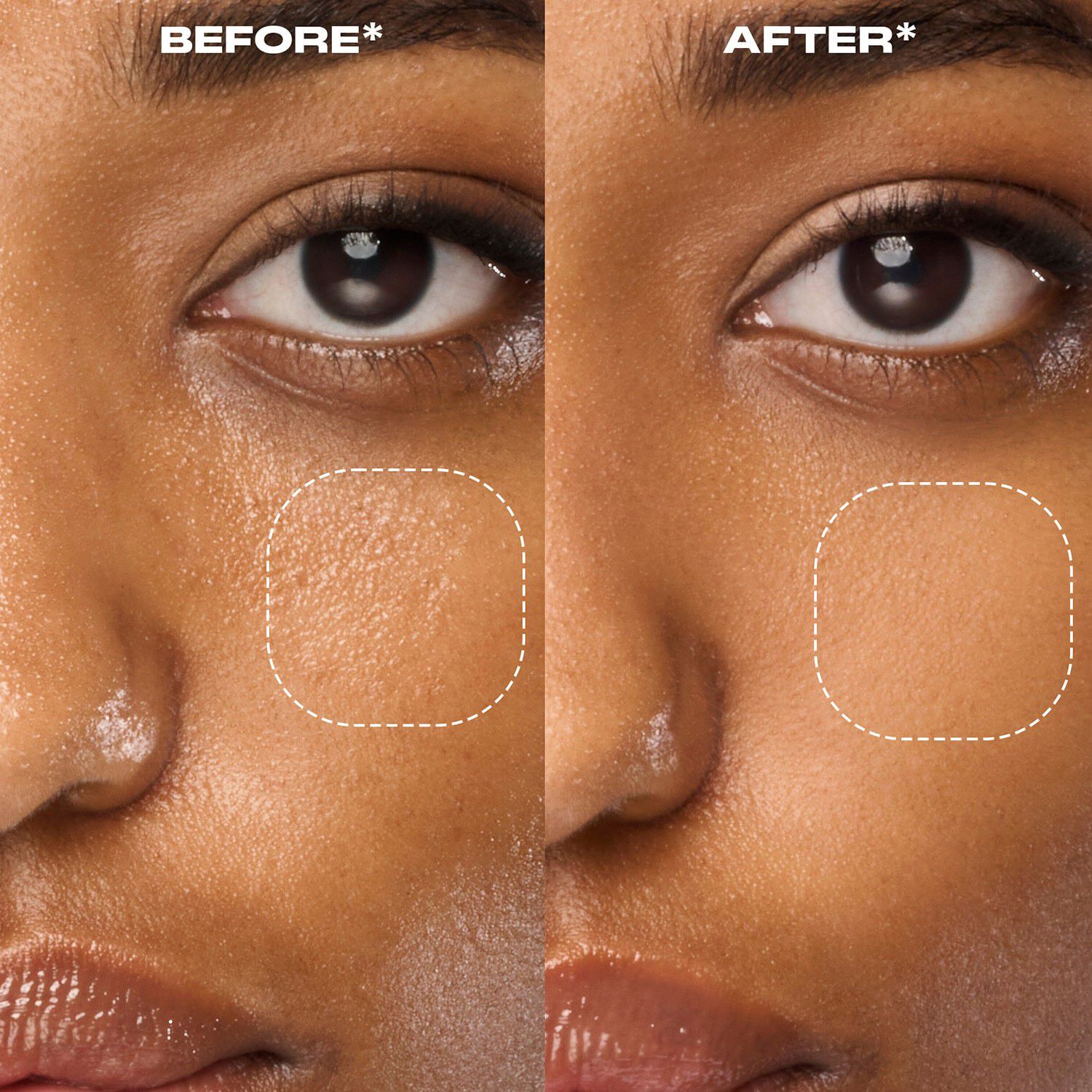 Secure the Blur - Fikserende og udj&aelig;vnende base