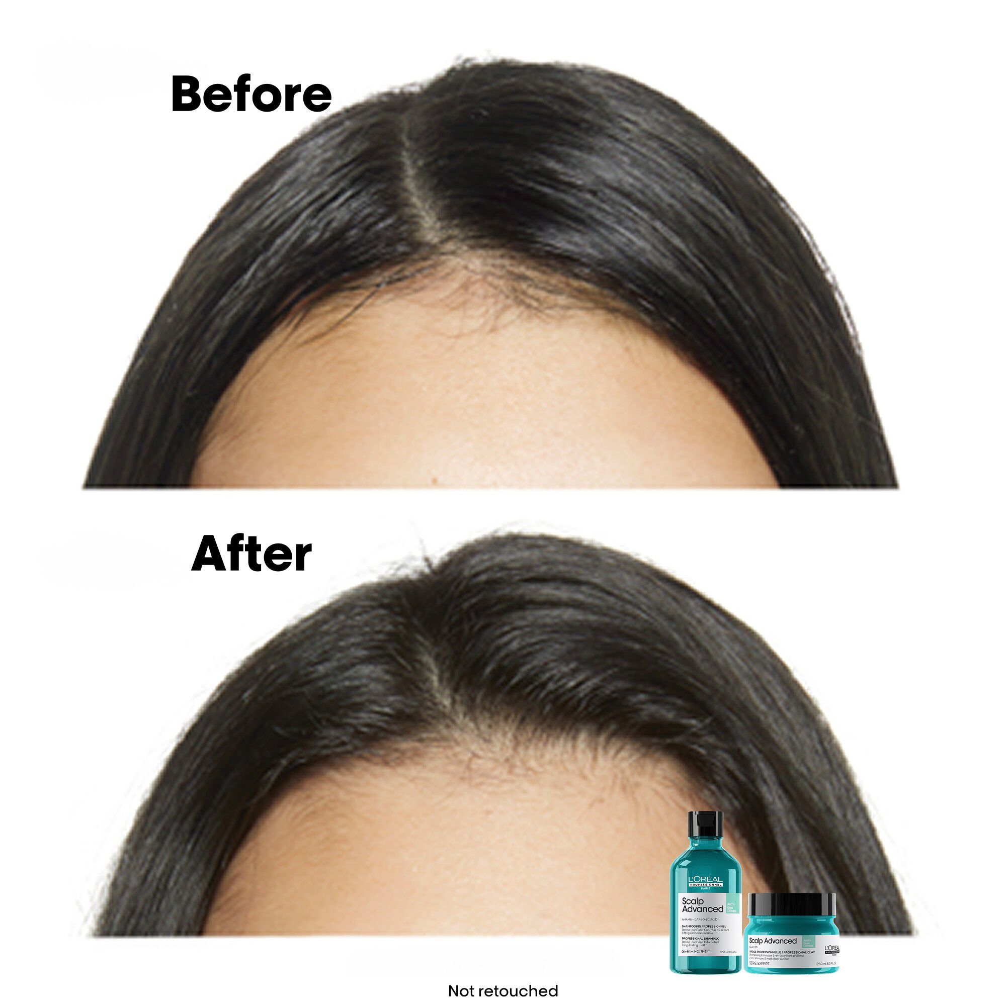 L'Or&eacute;al Professionnel Scalp Advanced Anti-Oiliness Shampoo 300ml