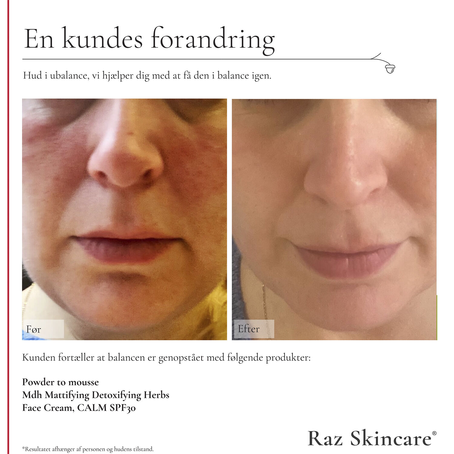 Raz Skincare Mdh Mattifying Detoxifying Herbs 30 ml