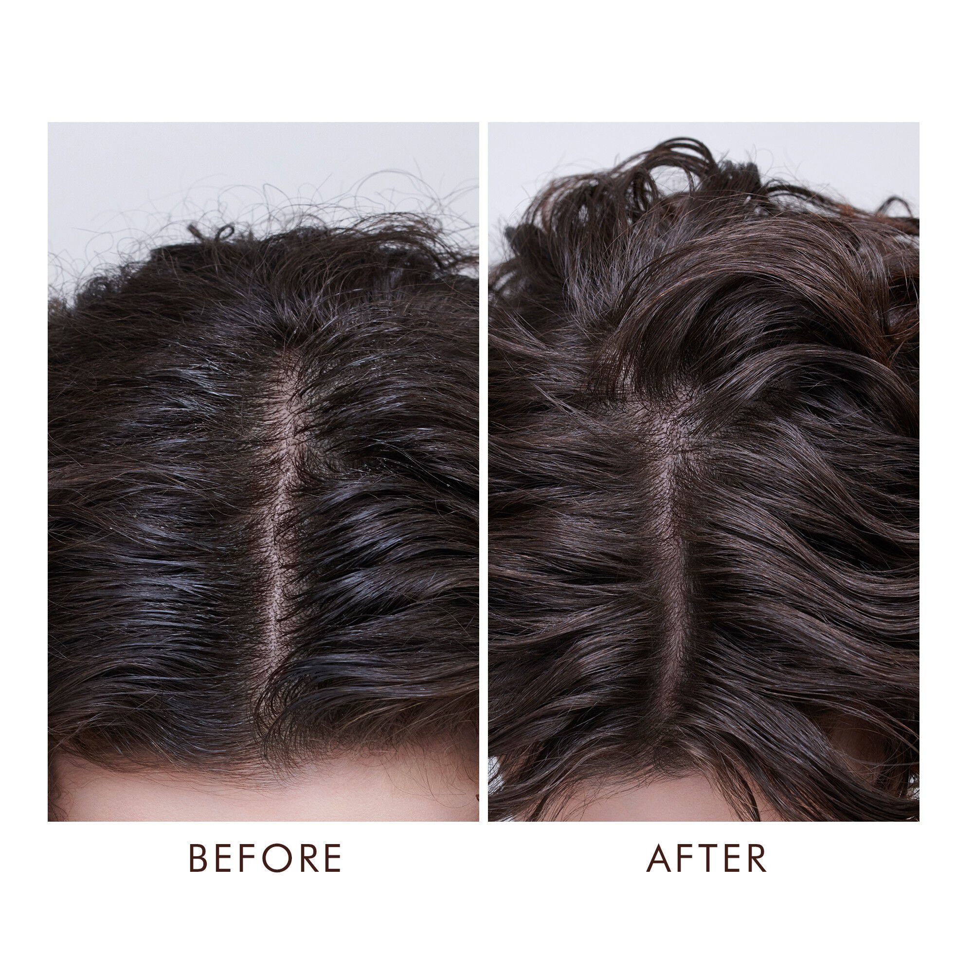 Oily Scalp Treatment, 45 ml.