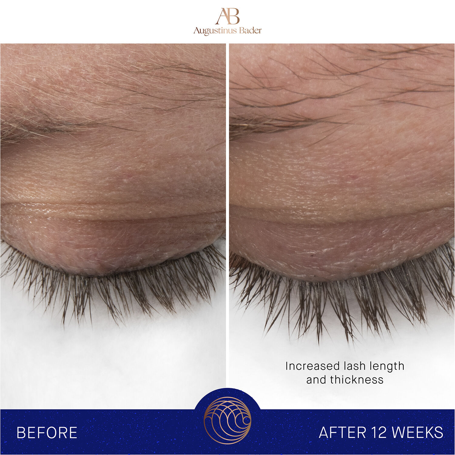 The Eyebrow & Lash Enhancing Serum