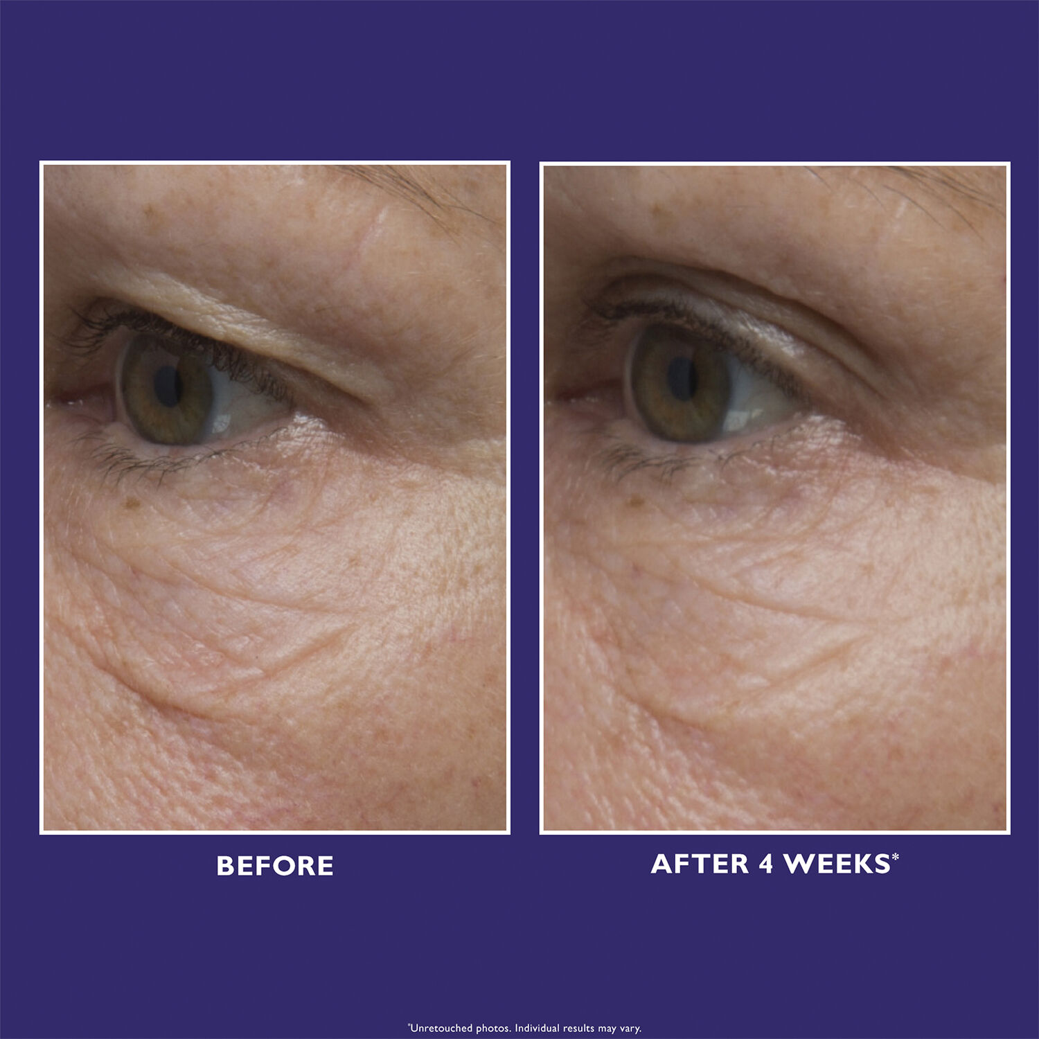 Peter Thomas Roth Ultimate Solution 5 Multitasking Eye Cream