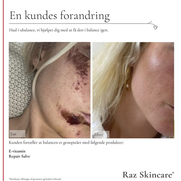 Raz Skincare E-Vitamin 30 ml