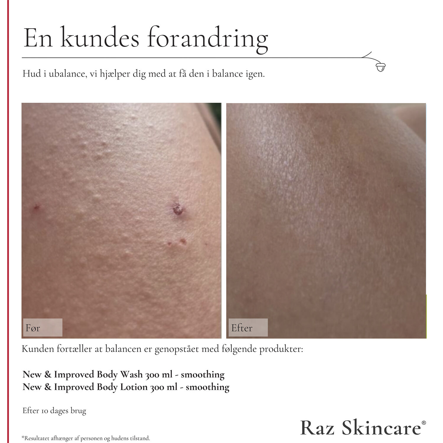 Smoothing Body Lotion