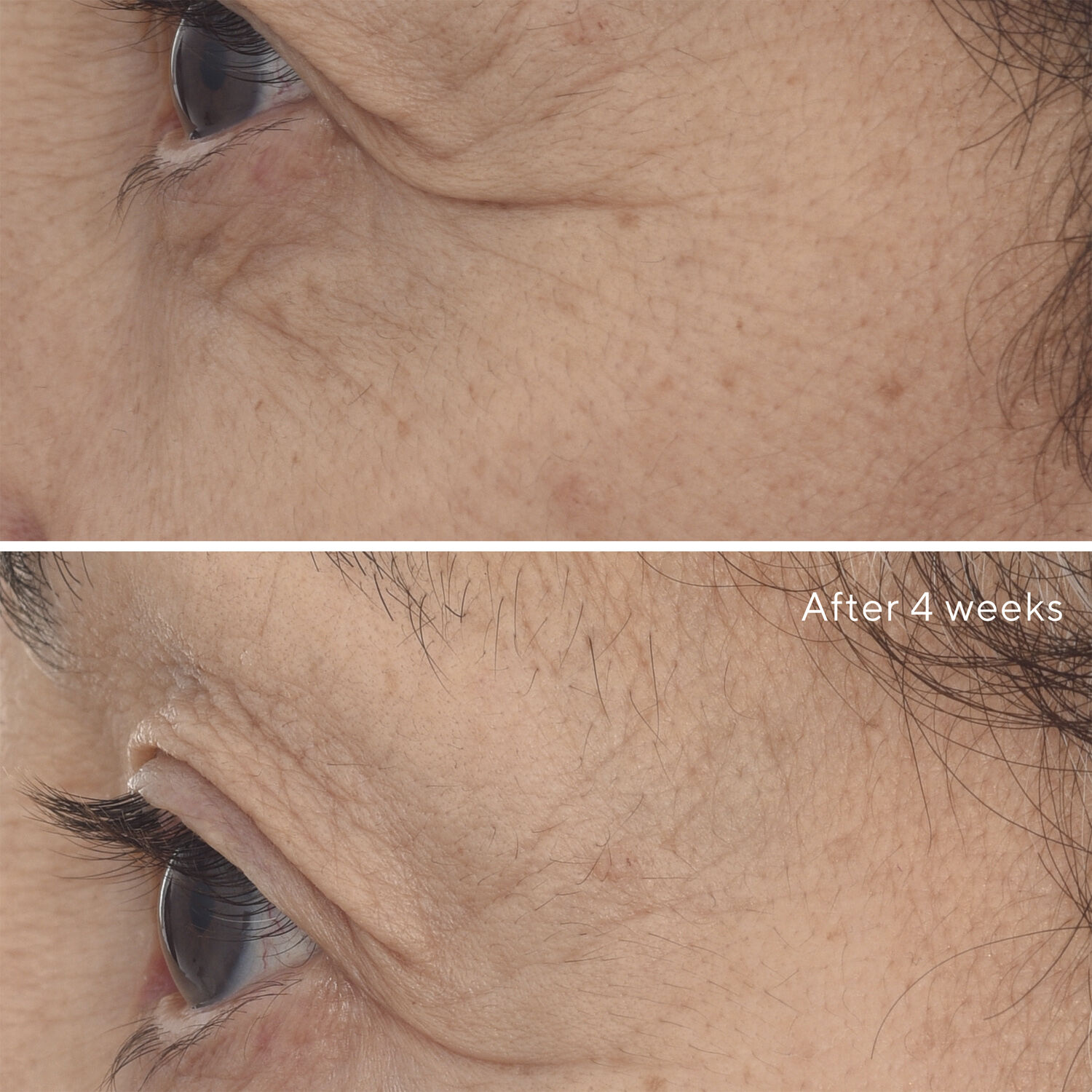 RETINAL RESCUPLT EYE TREATMENT 15 ML