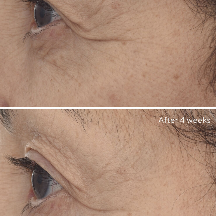 RETINAL RESCUPLT EYE TREATMENT 15 ML