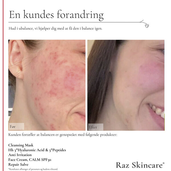 Raz Skincare Face Cream, CALM 50 ml