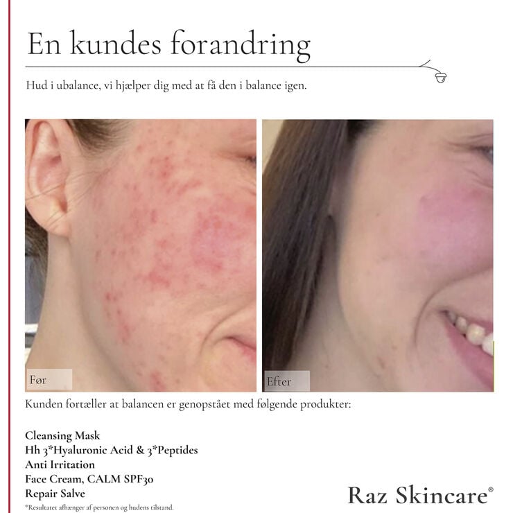 Raz Skincare Face Cream, CALM 50 ml