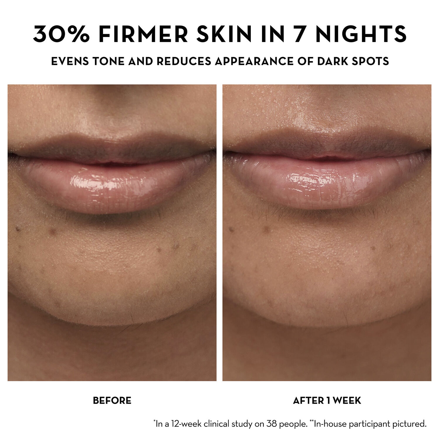 Dewtopia 5% Acid Firming natcreme