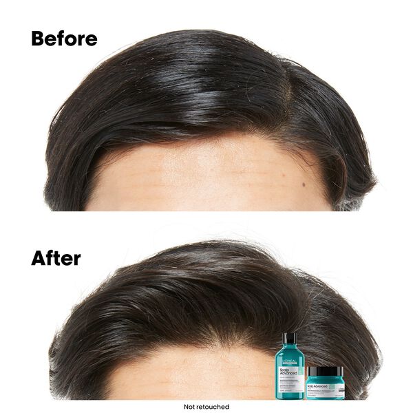 L'Oréal Professionnel Scalp Advanced Anti-Oiliness Shampoo 300ml