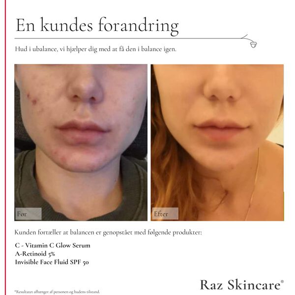 Raz Skincare C - Vitamin C Glow Serum 30 ml