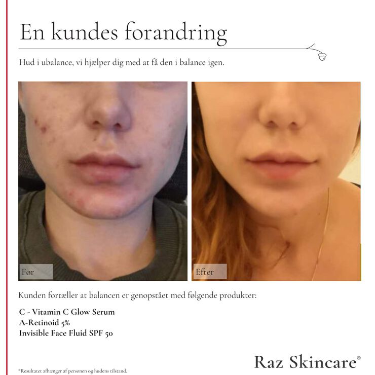 Raz Skincare C - Vitamin C Glow Serum 30 ml