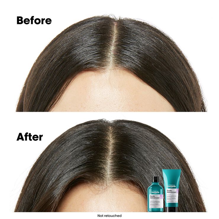 L'Oréal Professionnel Scalp Advanced Anti-Discomfort Treatment 200ml