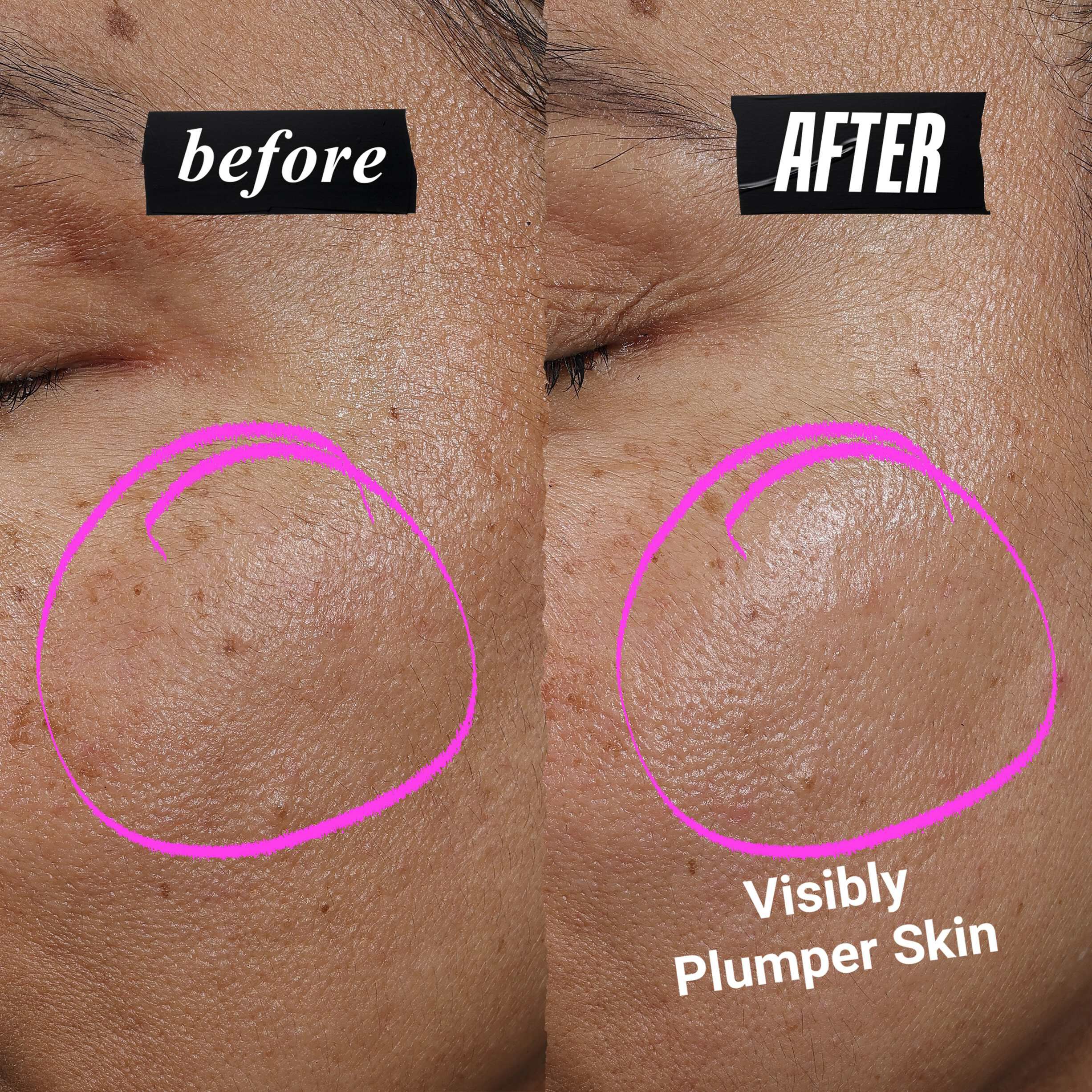 Collagen Shot Serum