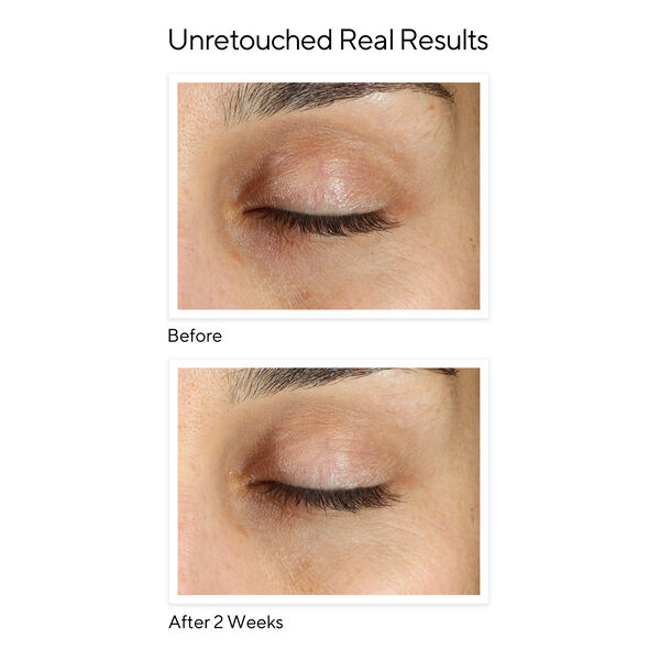 Vita-C Eyes Dark Circle Corrector