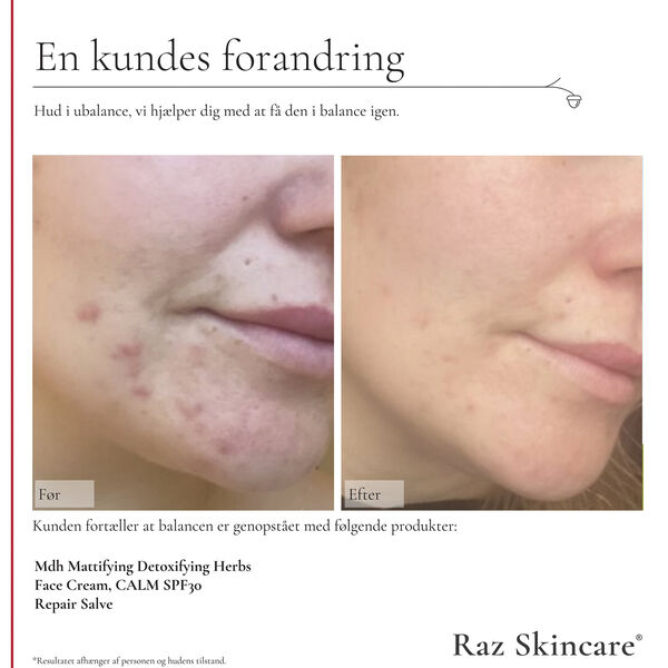 Raz Skincare Repair Salve Perfume Free 15 ml