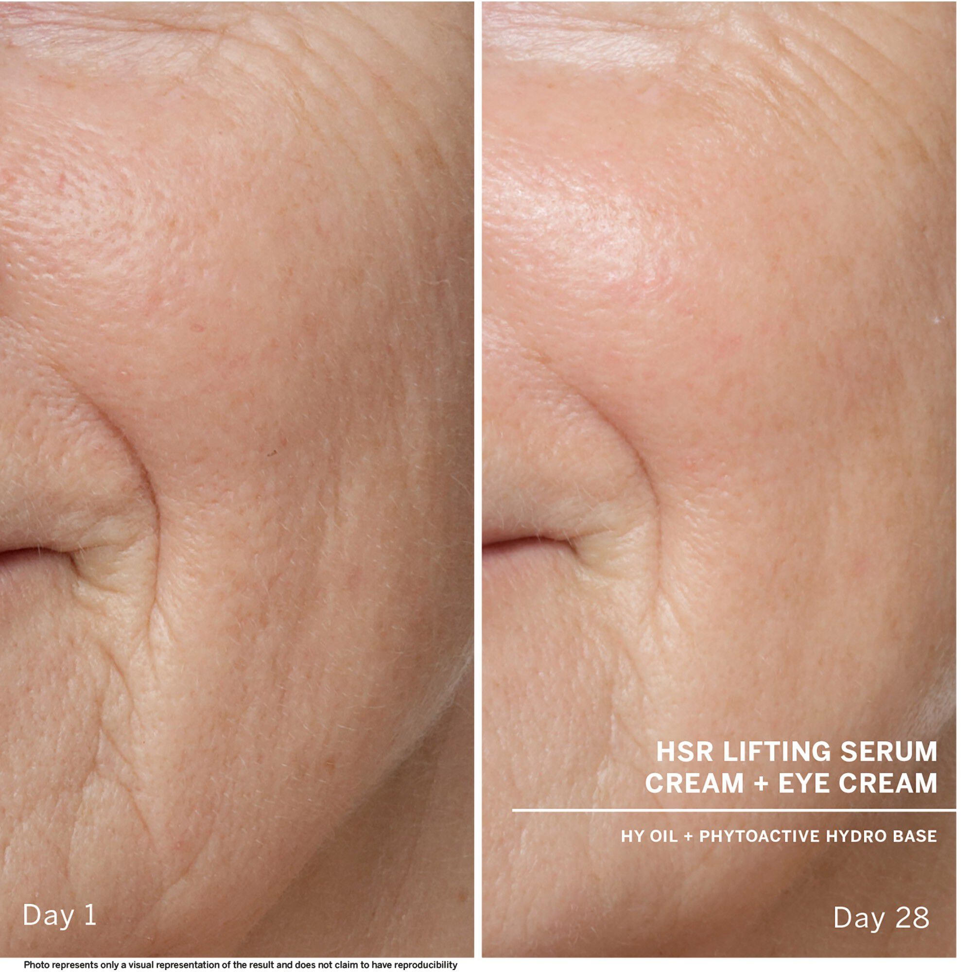 HSR anti-wrinkle serum