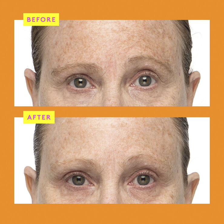 C-Firma Fresh Day Serum - C Vitamin Serum