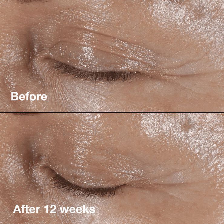 Smart Clinicial Repair Wrinkle Correcting Eye Cream