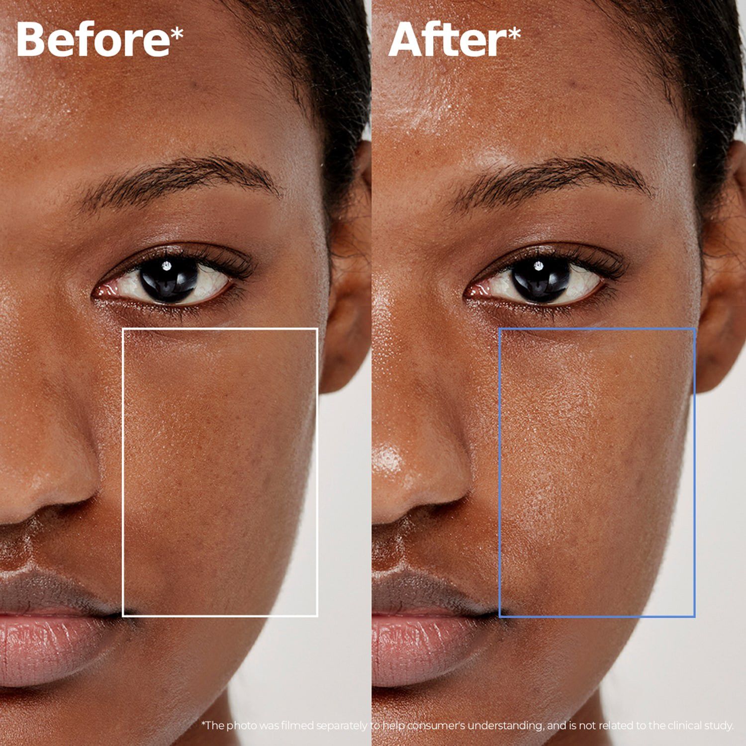 ATOBARRIER365 Lotion - Lotion, der hydrerer og styrker hudens barriere