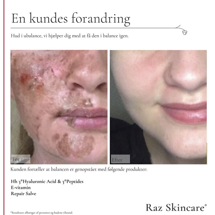 Raz Skincare Repair Salve Perfume Free 15 ml