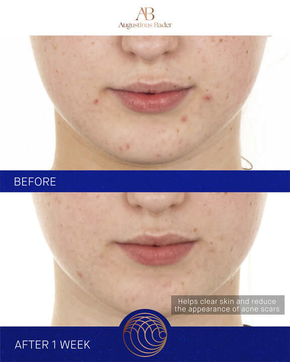 The Retinol Serum 15ml Nomade ROW