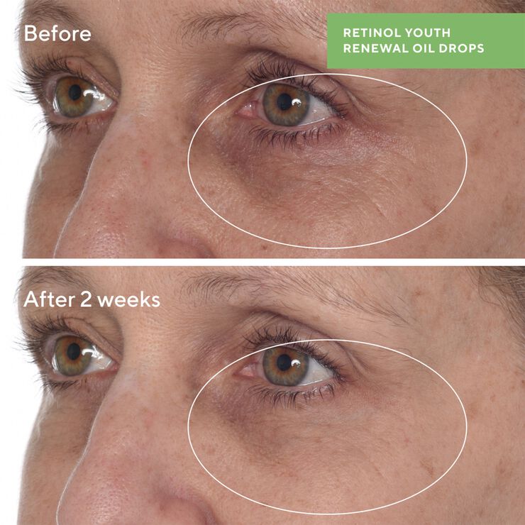 RETINOL YOUTH RENEWAL OIL DROPS 30 ML