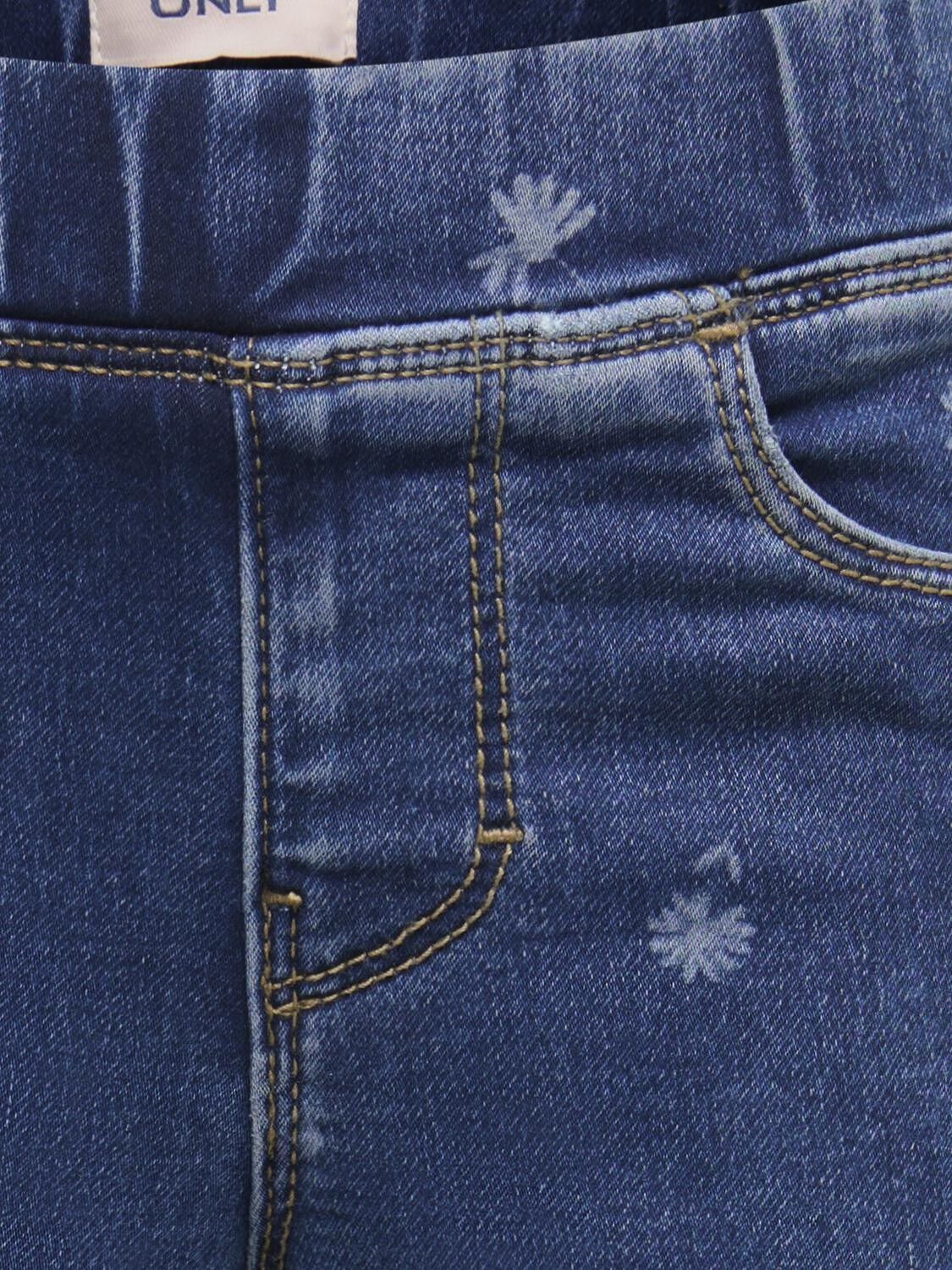 Kmgkyoto Reg Wide Flower Dnm Pim