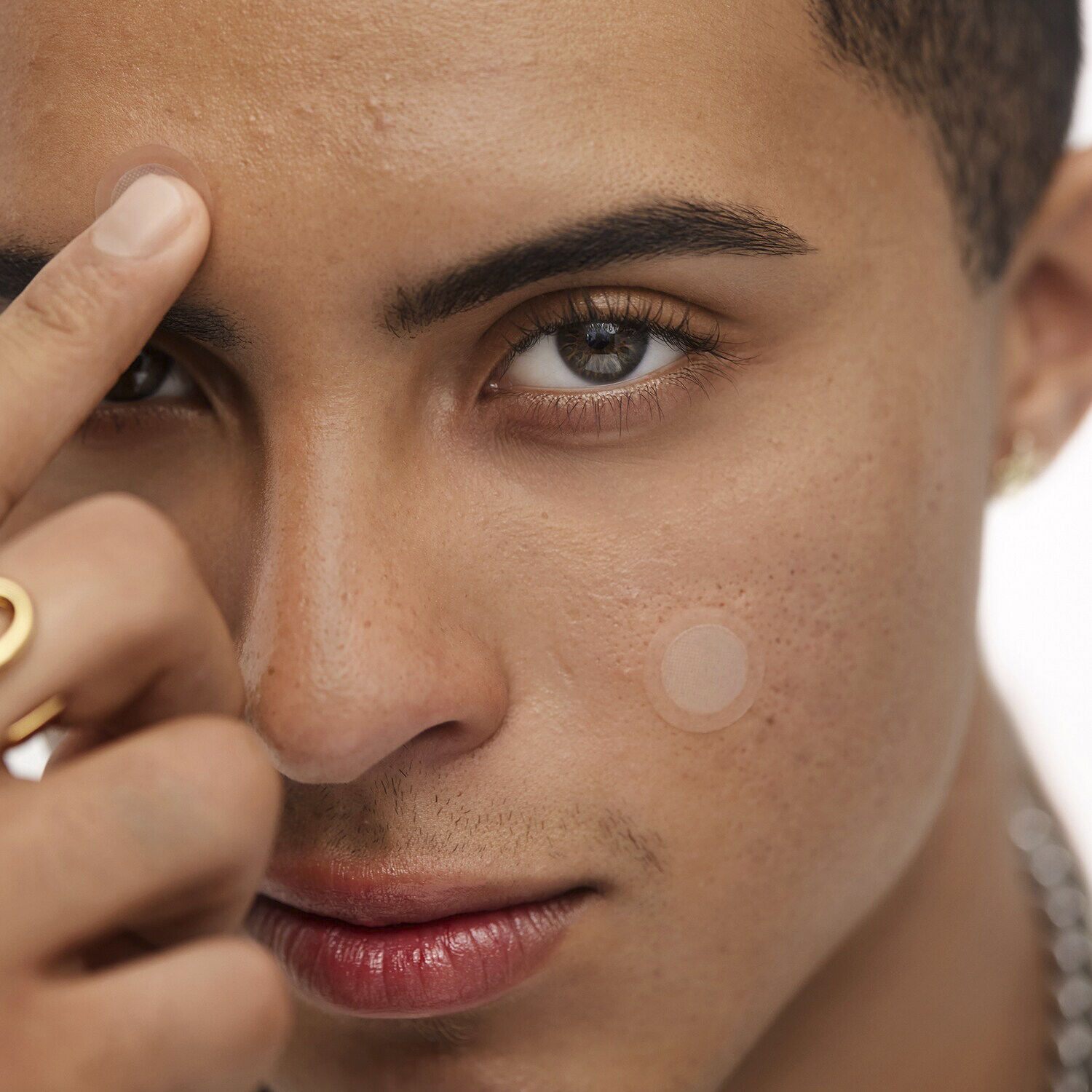 ACNE EARLY STAGE ACNE DOT 0. 74G