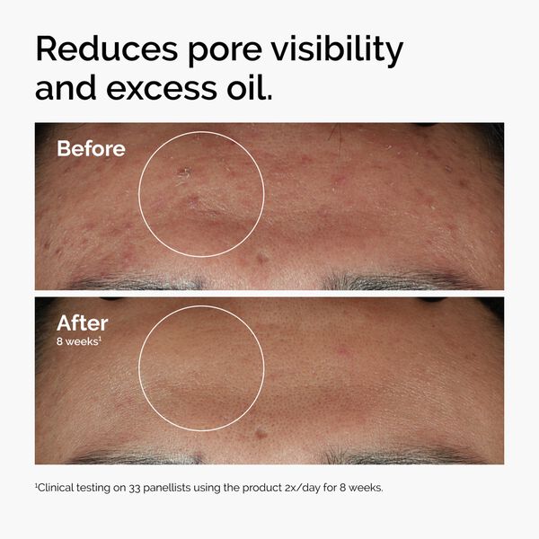 Niacinamide 10% + Zinc 1% 30 ml. Serum