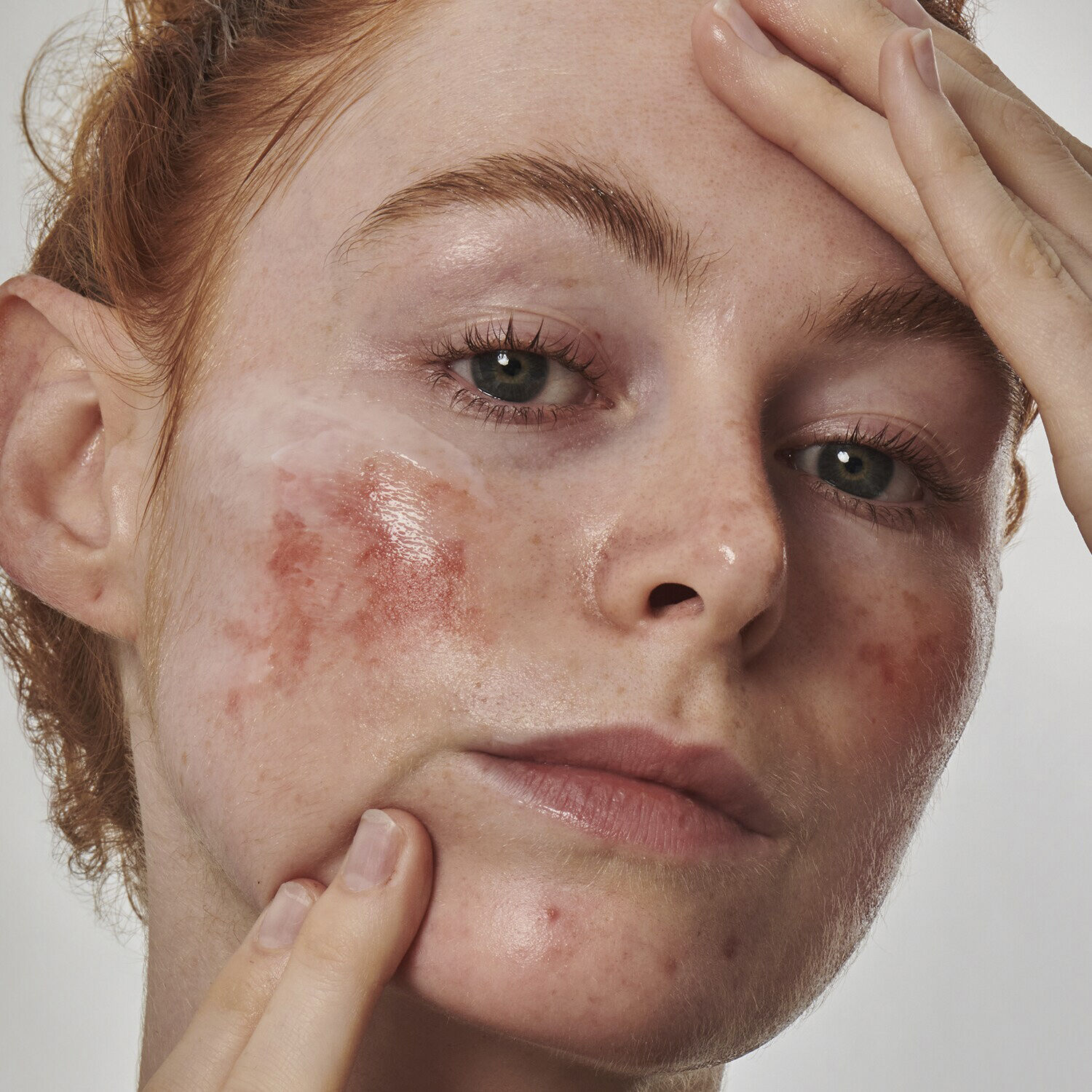 Redness Solution with 10% Azelaic - Face Serum