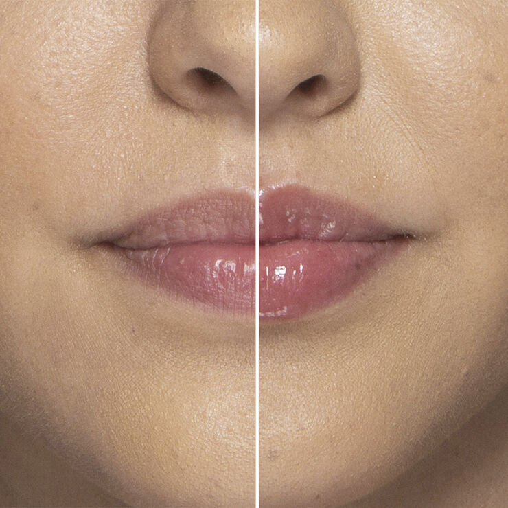 Lip Injection - Extreme Mini