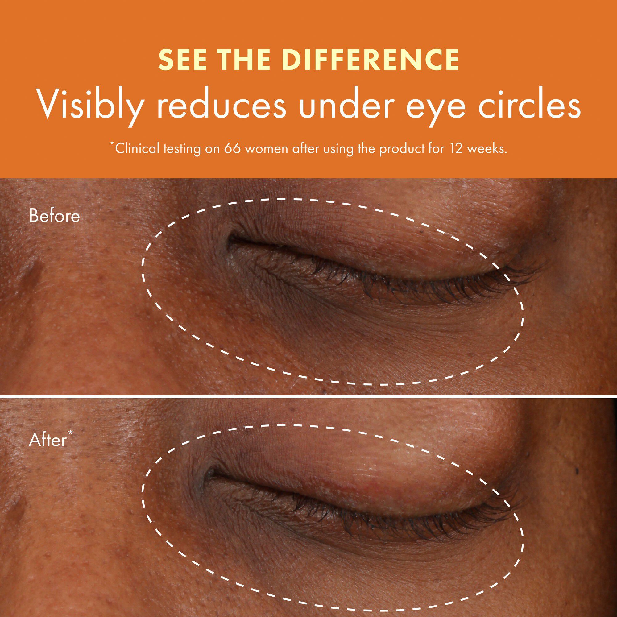 GinZing Refreshing Eye Cream to Brighten and Depuff