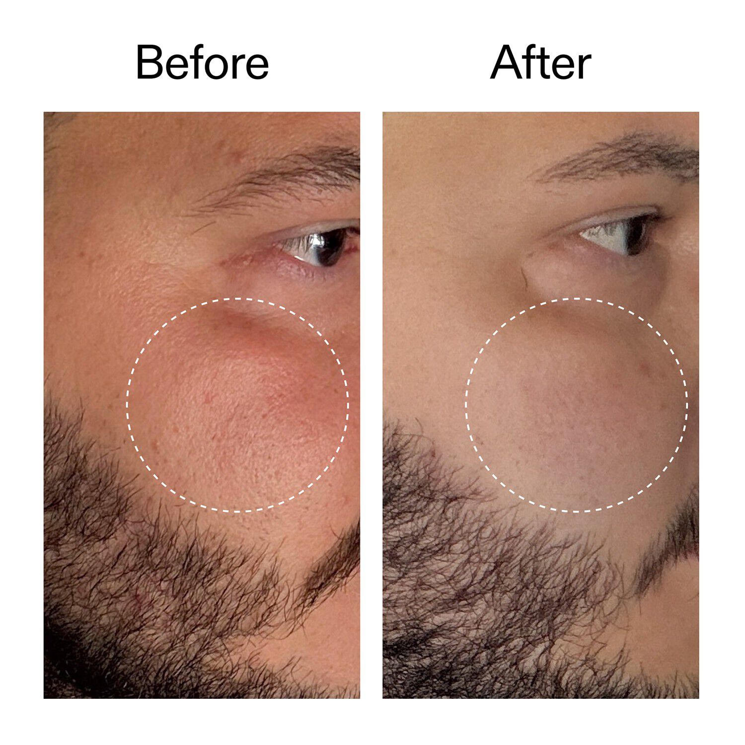 Starter Retinol Serum - Begynderretinolserum