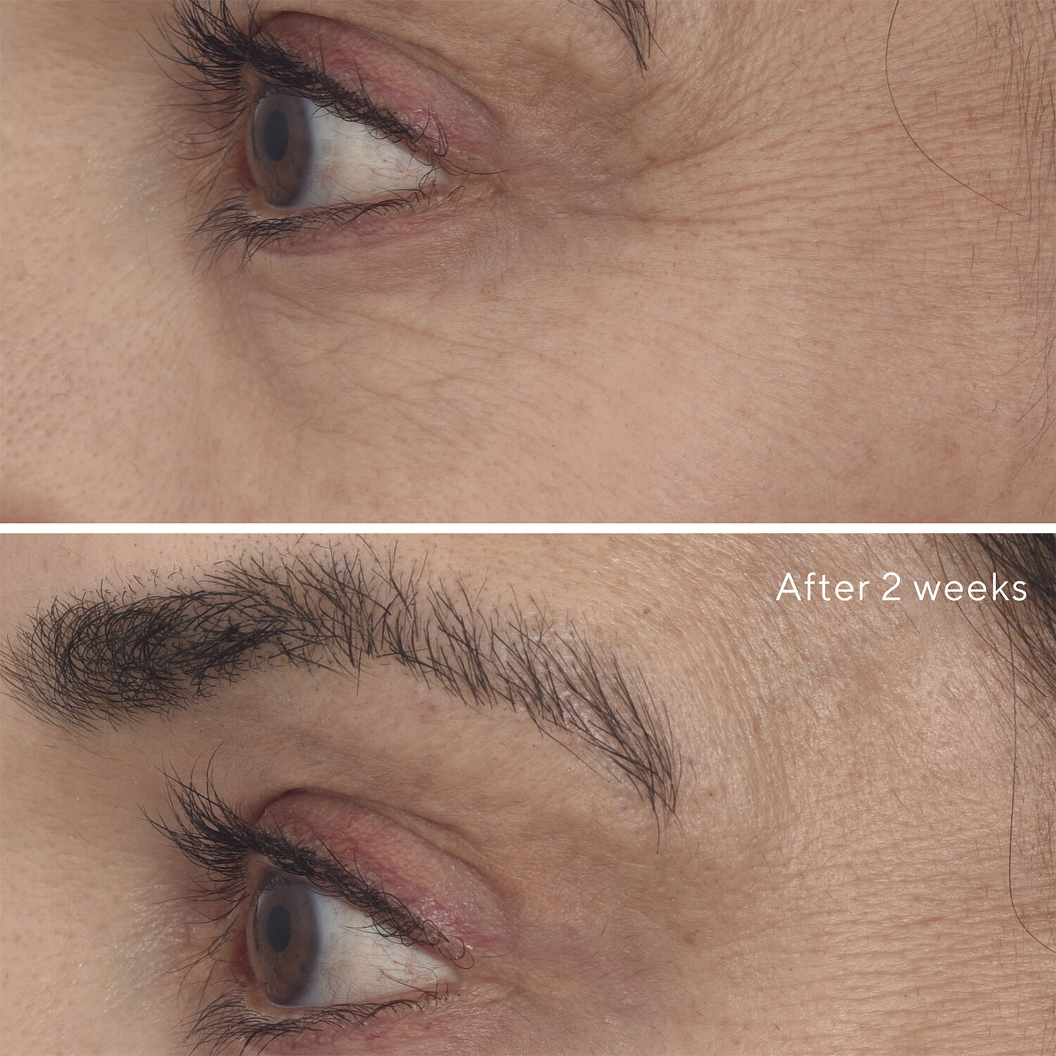 RETINAL RESCUPLT EYE TREATMENT 15 ML