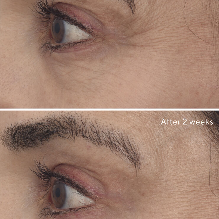 RETINAL RESCUPLT EYE TREATMENT 15 ML