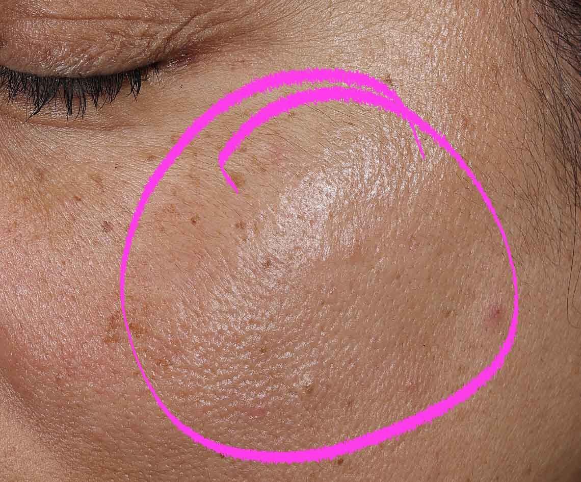 Collagen Shot Serum