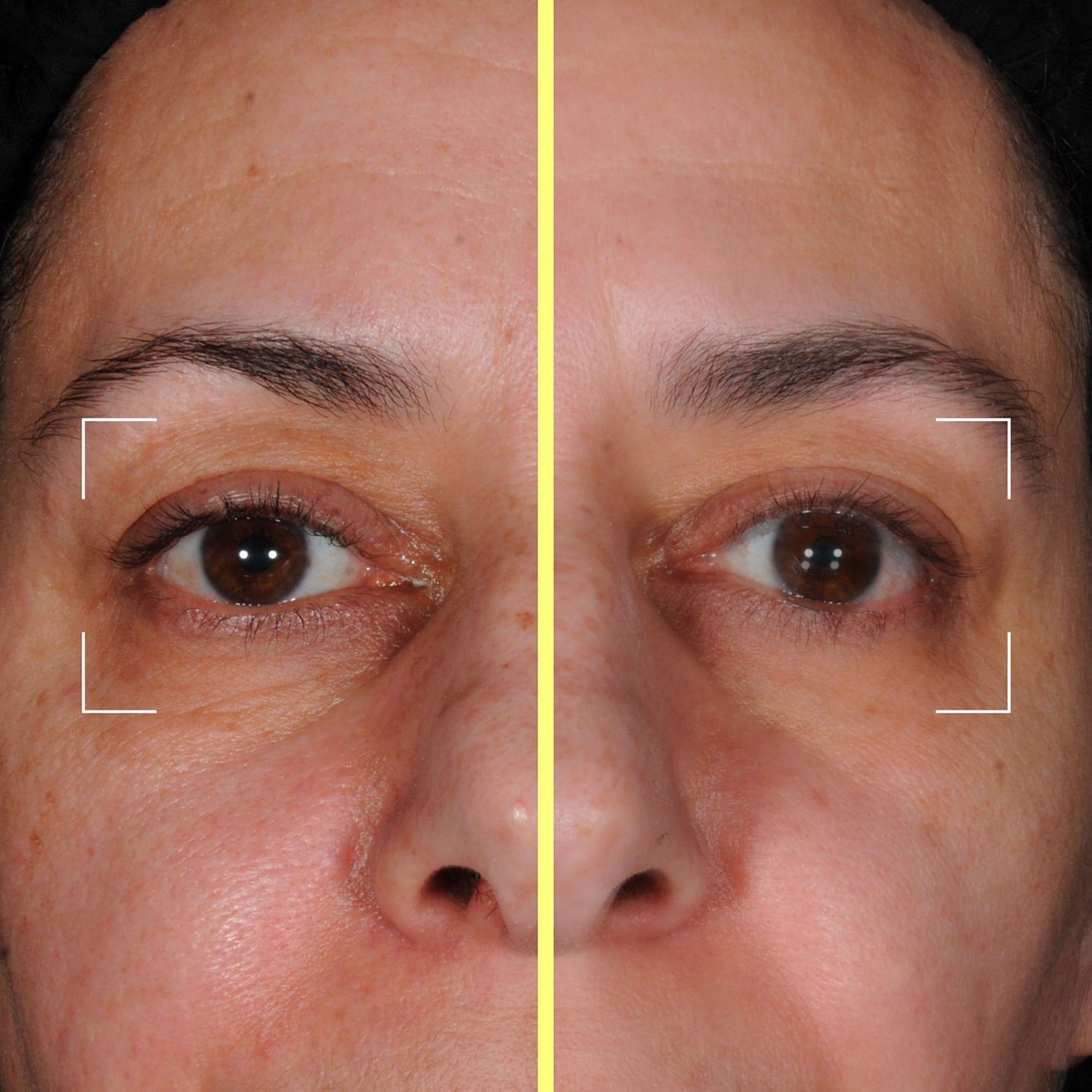 Eye kapsler - &Oslash;jenserum beriget med peptider, koffein, niacinamid