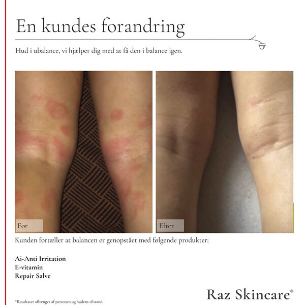 Raz Skincare Ai - Anti Irritation 300 ml