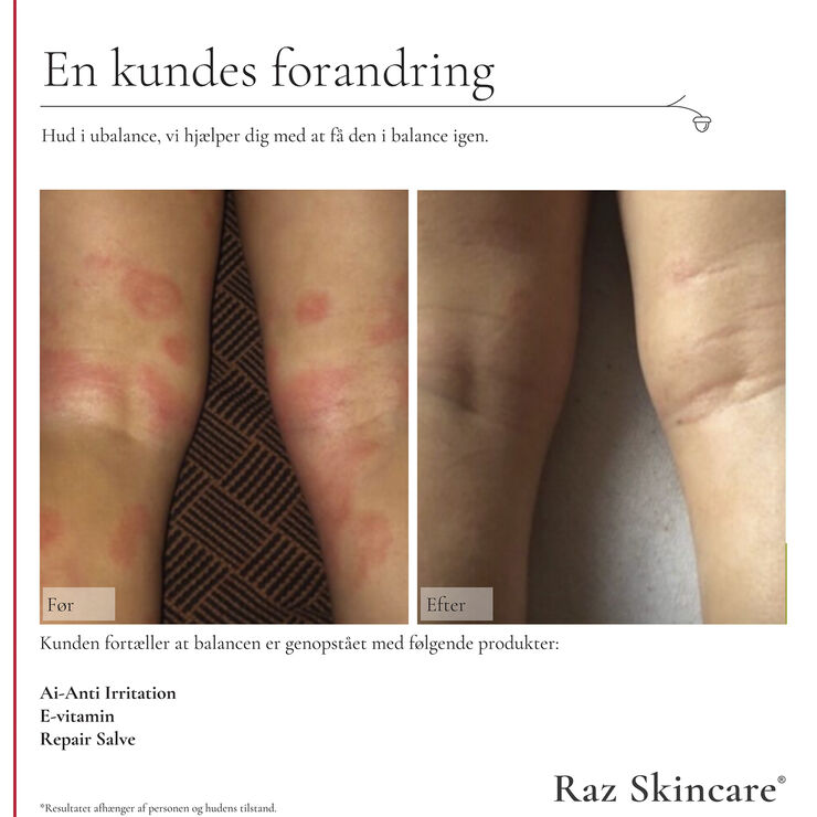 Raz Skincare Ai - Anti Irritation 300 ml